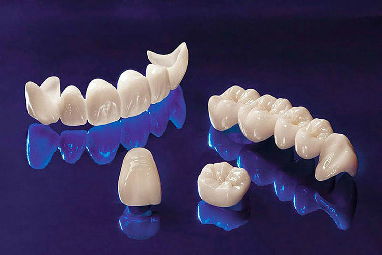 Dental crowns