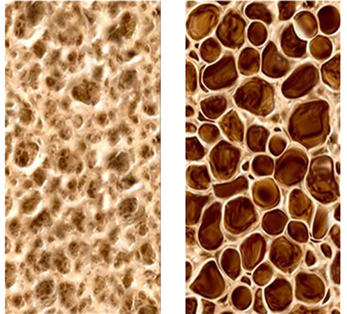 Immediate dental implants