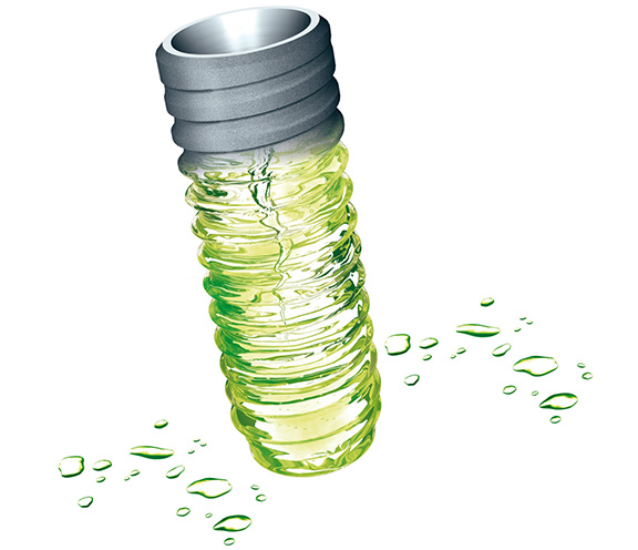 Dental implants
