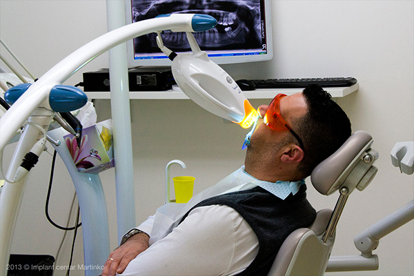 Teeth whitening