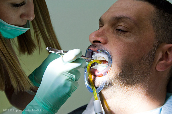 Teeth whitening