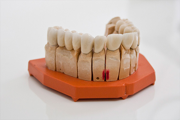 Conscious sedation