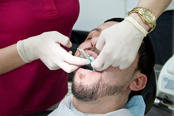 Conscious sedation