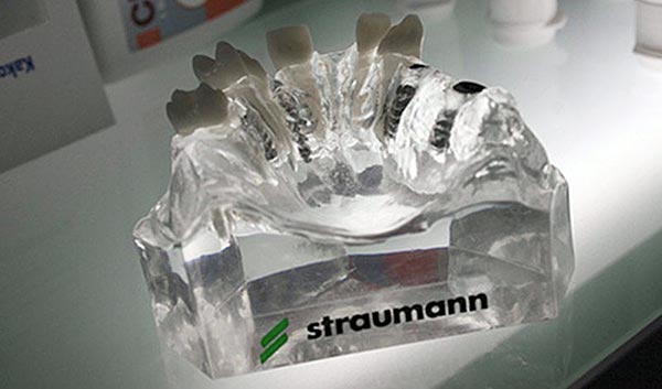 Straumann zubni implantati Straumann zubni implantati